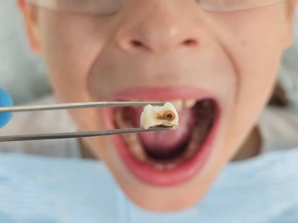 Emergency Dentist for Kids in IA